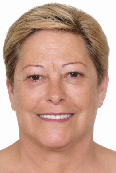 Esquela